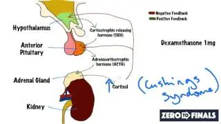 Understanding The Dexamethasone Suppression Test