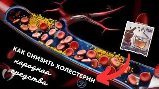 Как снизить холестерин в домашних условиях простой / Бабушкин простой народная средства