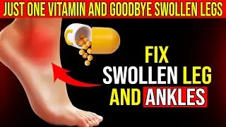 Say Goodbye to Swollen Legs and Ankles with THIS 1 Vitamin! -  No More Swollen Legs and Ankles!