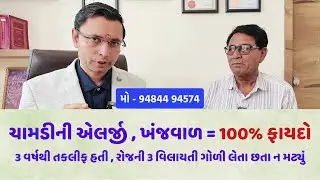 ચામડીની એલર્જી , ખંજવાળમાં 100% ફાયદો . રોજની 3 એલર્જીની ગોળી લેતા હતા #gujarati #ayurveda