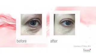 Smooth eyes!