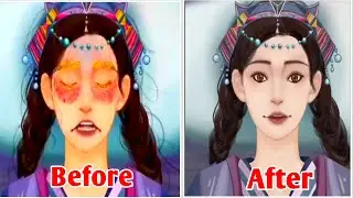 ASMR Eye discharge removal animation   Eyelid big acne extrusion and lashes lice deep cleaning