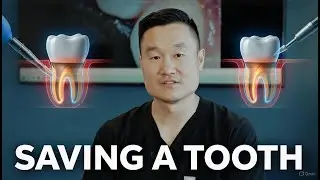 Saving a Dying Tooth: Full Root Canal Treatment + Post & Core Procedure Step by Step