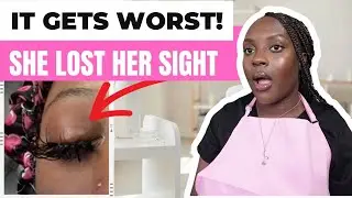 OMG!😱 EYELASH EXTENSION DISASTER 😱| IT WAS SWOLLEN SHUT! | LASH APPOINTMENT HORROR