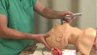 Lesson 5 - Direct Laryngoscopy: MICU Fellows Airway Course