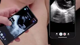 Ultrasound Education: Cardiac Image Optimization