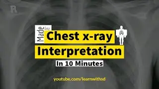 Chest X-ray Interpretation | How to read Chest X-ray in 10 Minutes | Abnormal vs Normal | Radiology.