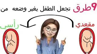 وضع الجنين المقعدي أحسن الطرق لجعله يغير وضعيته. متى تكون الولادة الطبيعية ممكنة؟ تعديل وضع الجنين