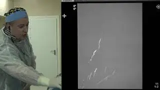 Ангиодроид Трансляция Деркач Ангиопикча