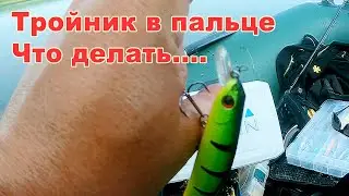 Как извлечь из пальца тройник от воблера или крючок от блесны ?