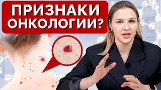 How DANGEROUS are red moles on your SKIN?! / Should you REMOVE hemangiomas?
