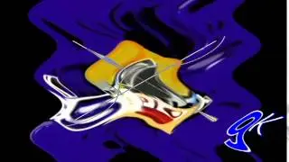 Klaskinny Csupo????
