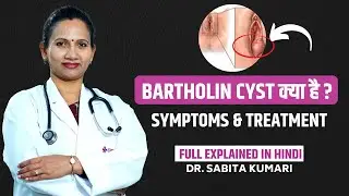 What Is Bartholin Cyst ? | बार्थोलिन सिस्ट क्या है और इसका इलाज कैसे होगा ?
