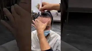 Solusi kebotakan untuk Rambut M