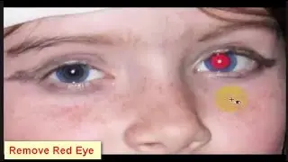 How To Remove Red-Eye In Photoshop CC! Fast And Easy । 4K । HD