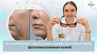 Фототерапия и фотоомоложение кожи лица и тела