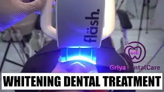 WHITENING TEETH - DENTAL BLEACHING
