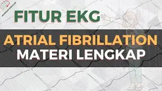 ATRIAL FIBRILLATION DAN FITUR EKG | SISTEM KARDIOVASKULAR