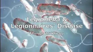 Legionella and Legionnaires' Disease - Things to Know