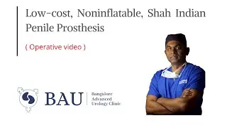 Penile implant surgery in Bangalore / Low-cost, Non-inflatable, Shah Indian penile prosthesis .