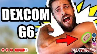 How To Change Your DEXCOM G6 SENSOR
