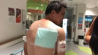 he needed 20 STITCHES!!