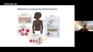 Healer J (2020): Why is it so hard to make a malaria vaccine?