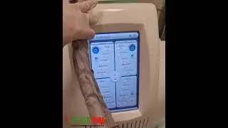 Кріоліполіз Київ