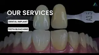 dental4