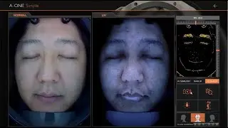 How to operate A-ONE Simple