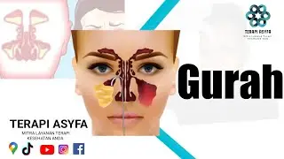 Gurah