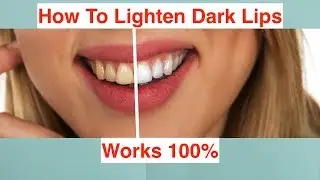 How To Lighten Dark Lips | Works 100%