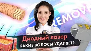 What hair does a diode laser remove and what does not? \ Diode laser hair removal [LASERTECH] 18+