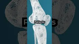 This condition sees patients turn to STONE 😨 