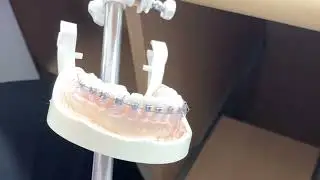🎓나는 교정전문 치과위생사!!📌  교정 호선 결찰 실습 및 치간이개(완서이개) 💯