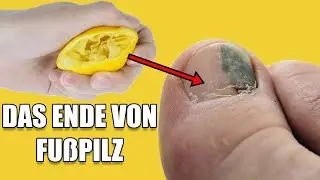 Dieses Mittel nur einmal aufgetragen entfernt sofort lästigen Pilz.