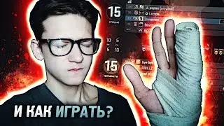 СЛОМАЛ РУКУ В CS:GO