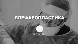 Акция на блефаропластику у Ворошкевича Андрея Альбертовича