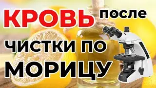 Как влияет на кровь чистка печени по Морицу? Мой тест с микроскопом