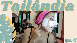 Viver na Tailândia - ep 8: Como elimino os pontos negros da pele