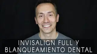 La sonrisa de Santiago: Invisalign Full y blanqueamiento dental combinado