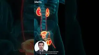 What Is Ureterocele? #shorts