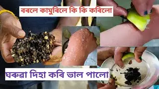 Borole kamurile ki kribo lage | ঘৰুৱা দিহা | বৰল মৌ মাখিয়ে কামুৰিলে এইকেইটা কাম কৰিব লাগে |