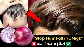 प्याज़ में सिर्फ एक चीज मिलालो बाल इतने लंबे,मोटे  हो जाएंगे कि सब चौंक जाएंगे | Fastest Hair Growth
