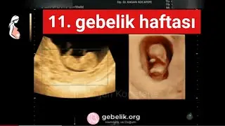 10 haftalık gebelikte bebeğin ultrason görüntüleri. 11. hafta başlangıcı. HD 4 boyutlu görüntüler.