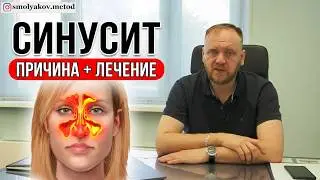 СИНУСИТ это что | медицинские термины простыми словами