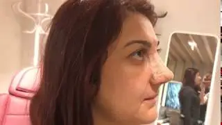 Burun Ameliyatı Sonrası!!