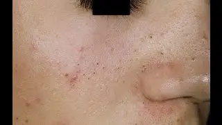 Сонник черные точки