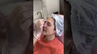 Процедура ботокса 💉#shorts #ботокс #ботулинотерапия #косметолог #botox #увеличениегуб #скайсы