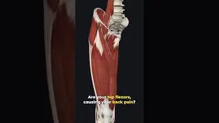 Got Back Pain? Check Your Hips